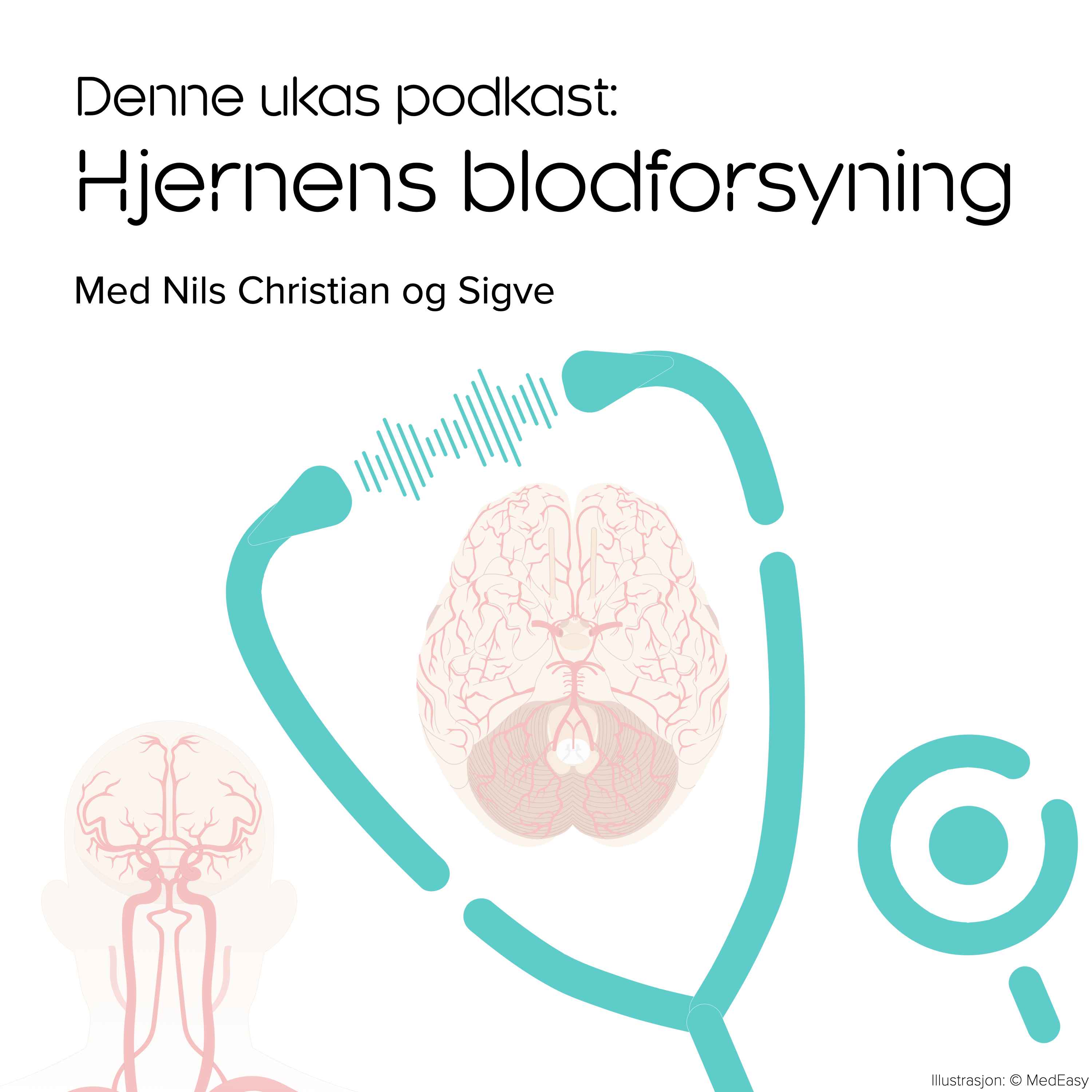 Hjernens blodforsyning